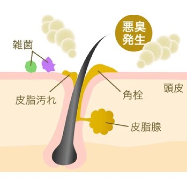 頭皮の毛穴汚れをとってスッキリ！